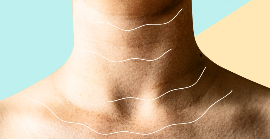 signs of neck aging